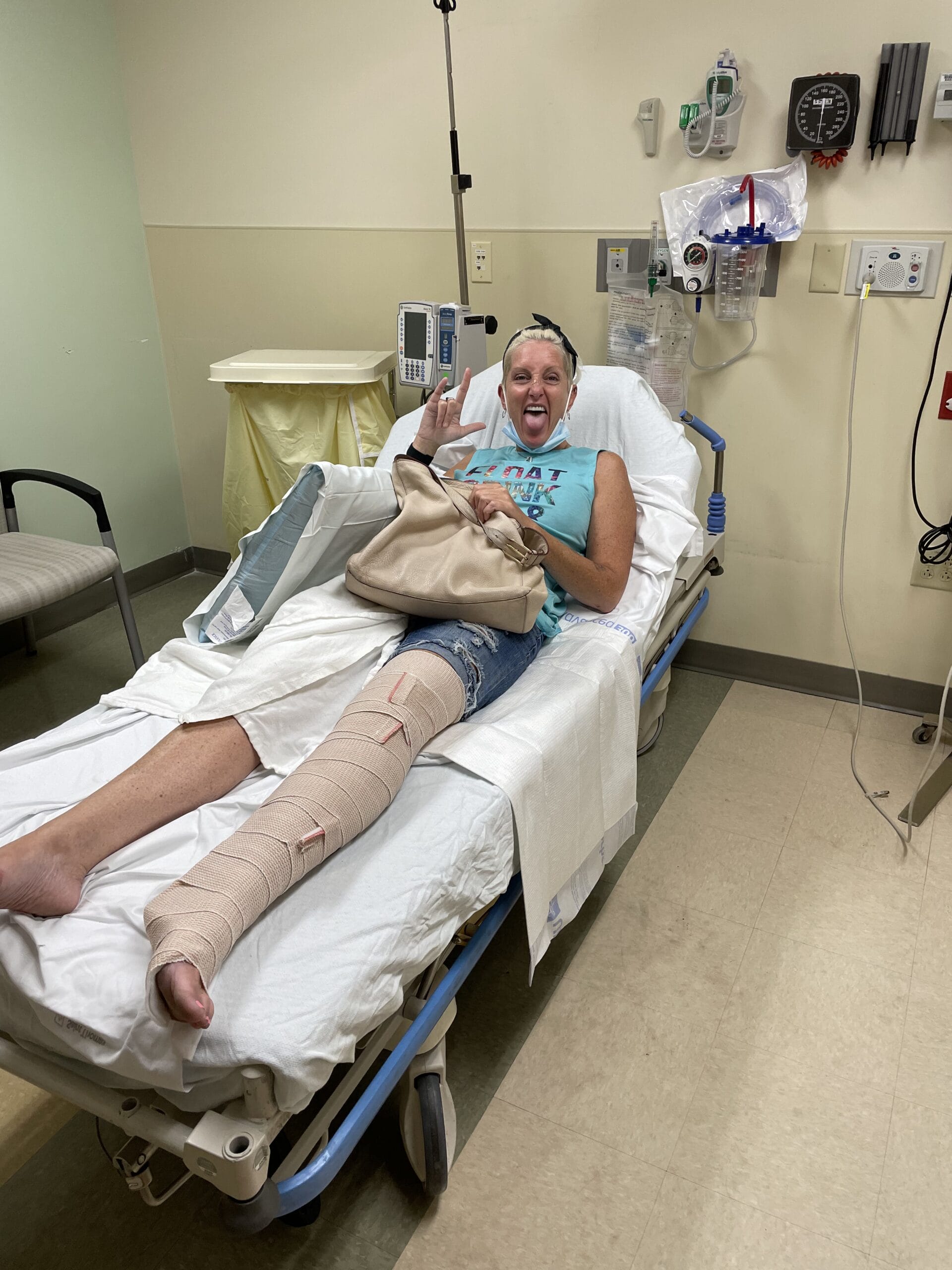 BROKE MY LEG IN 3 PLACES BROKE MY LEG IN 3 PLACES