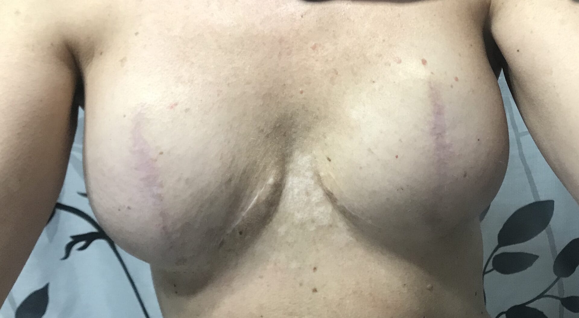 story#5 Built Jones TOugh Foundation